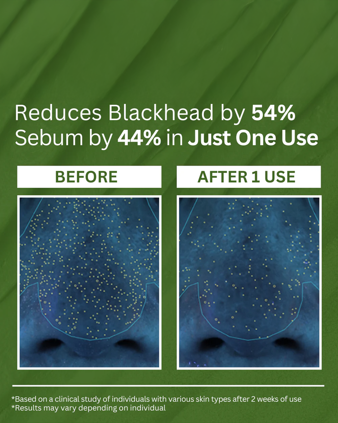 Holy Basil Sparkling Bubble Mask Free